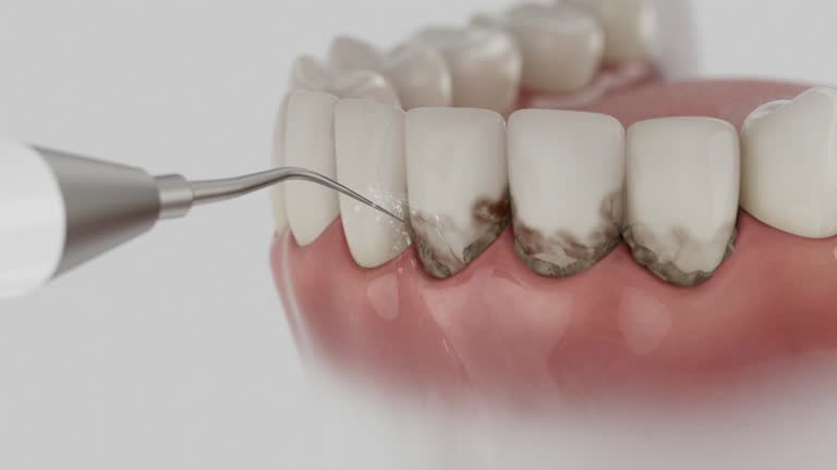 Reliable Dental Implants contractor in Danielson, CT by Smile Center Dentistry